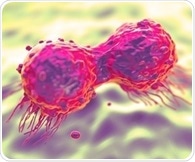 Liquid biopsy predicts immune response in high-risk breast cancer patients