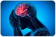 Scientists uncover why brain damage continues after stroke