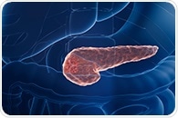 New technique uses electronic jolt and nanoparticles to reveal early signs of pancreatic cancer