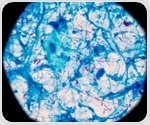 Portable MiniDock MTB delivers tuberculosis results in thirty minutes