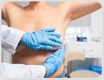 How cost, access, and awareness barriers are slowing BRCA testing