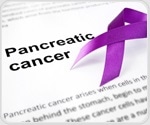 Inflammation from leaking mitochondria drives aggressive pancreatic cancer growth