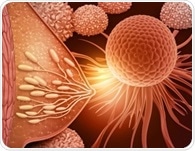 Intermediate PRRX1 levels drive breast cancer metastasis risk