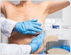 How cost, access, and awareness barriers are slowing BRCA testing