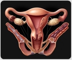 New imaging agent shows promise for non-invasive endometriosis diagnosis