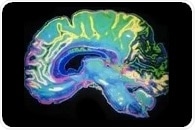Glucose acts as a metabolic signal for myelin development