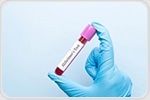 Identifying the ages when Alzheimer’s biomarkers sharply change