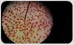 Deep Learning-Enabled Microscopy Reveals Biomolecular Dynamics in Cells