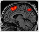 Study links metabolic dysfunction to cognitive impairment in bipolar disorder