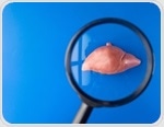 Liver fat may disrupt post-meal glucagon control in early type 2 diabetes