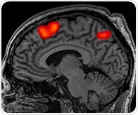 Study links metabolic dysfunction to cognitive impairment in bipolar disorder