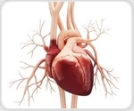 Ultra processed foods linked to higher cardiovascular disease and death