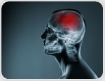 Brain artery widening may drive lacunar stroke more than artery narrowing