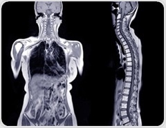 AI-powered MRI scans predict diabetes and heart disease risk