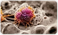 How nanoparticles could help immunotherapy turn cold tumors hot