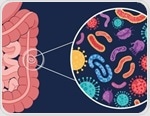 How diet influences the gut microbiome and overall health