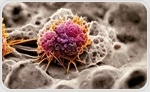 How nanoparticles could help immunotherapy turn cold tumors hot
