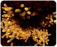 Scientists call for innovative strategies to combat tuberculosis superspreaders