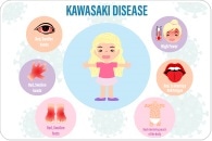 Global collaboration can improve diagnosis and care for children with Kawasaki disease