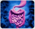 Body weight and genes directly alter gut microbiota composition