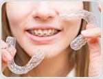Clear aligners protect oral microbiome better than fixed braces