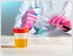 New guidance on diagnosing UTIs without an in-person exam