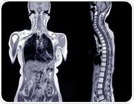 AI-powered MRI scans predict diabetes and heart disease risk
