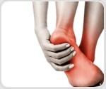Smart technology meets wound care to combat dangerous diabetic ulcers