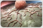 Light-driven nanomotors improve multimodal breast cancer treatment efficacy