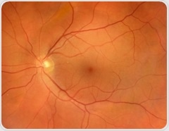 AI eye scans reveal who may be at higher risk of osteoporosis