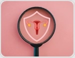 Why experts say PCOS needs a new name