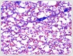 Choosing the right camera for clinical microscopy