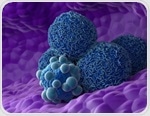 Scientists reveal why common pancreatic precancer lesions rarely turn deadly