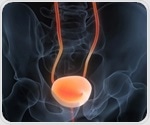 New peptide triggers domino effect to suppress bladder cancer