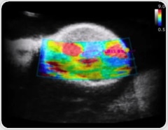 Clinical vs. preclinical ultrasound: Frequency effects
