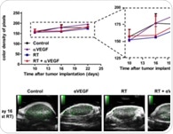 Non-invasive imaging of tumor vascular response