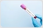 Blood metabolite patterns could reveal dementia risk in midlife