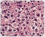 Synthetic Biology and Artificial Intelligence Transform the Discovery of Mysterious Orphan Receptors