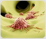 High-risk prostate cancer patients benefit from perioperative apalutamide therapy