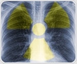 New PET imaging approach may enable early CTE diagnosis