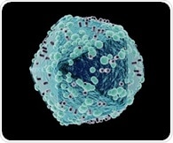 Study shows how HIV leads to chronic pain