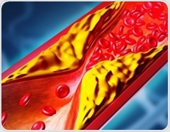One-time gene editing cuts LDL cholesterol in early hypercholesterolemia trial