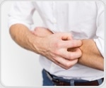 Childhood eczema may limit educational and career opportunities later