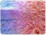 Mesenchymal drift may explain how aging cells lose their identity