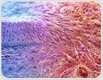 Mesenchymal drift may explain how aging cells lose their identity