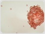 Bispecific Antibodies Target Tumors While Sparing Healthy Tissue