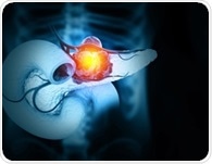Three-drug strategy forces pancreatic tumors into lasting regression