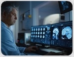 AI maps how brain fluids move to clear waste