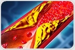 One-time gene editing cuts LDL cholesterol in early hypercholesterolemia trial