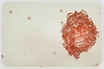 Bispecific Antibodies Target Tumors While Sparing Healthy Tissue
